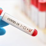 Public health labs worry 'bad data' could taint US recovery from coronavirus crisis.