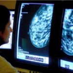 Cancer charities call for earlier diagnosis as cases projected to surge in England by 2040
