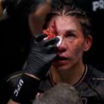 UFC fans in shock as fighter suffers HORROR facial injury